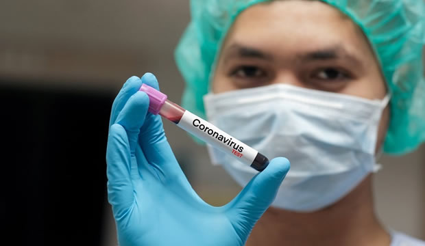 Cinco maneras de estimular tu sistema inmunológico ante el Covid-19