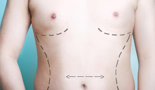 ¿Es posible realizarse una cirugía estética si tengo diabetes?