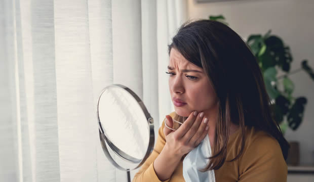 ¿Acné adulto en mujeres?, más allá de un problema estético