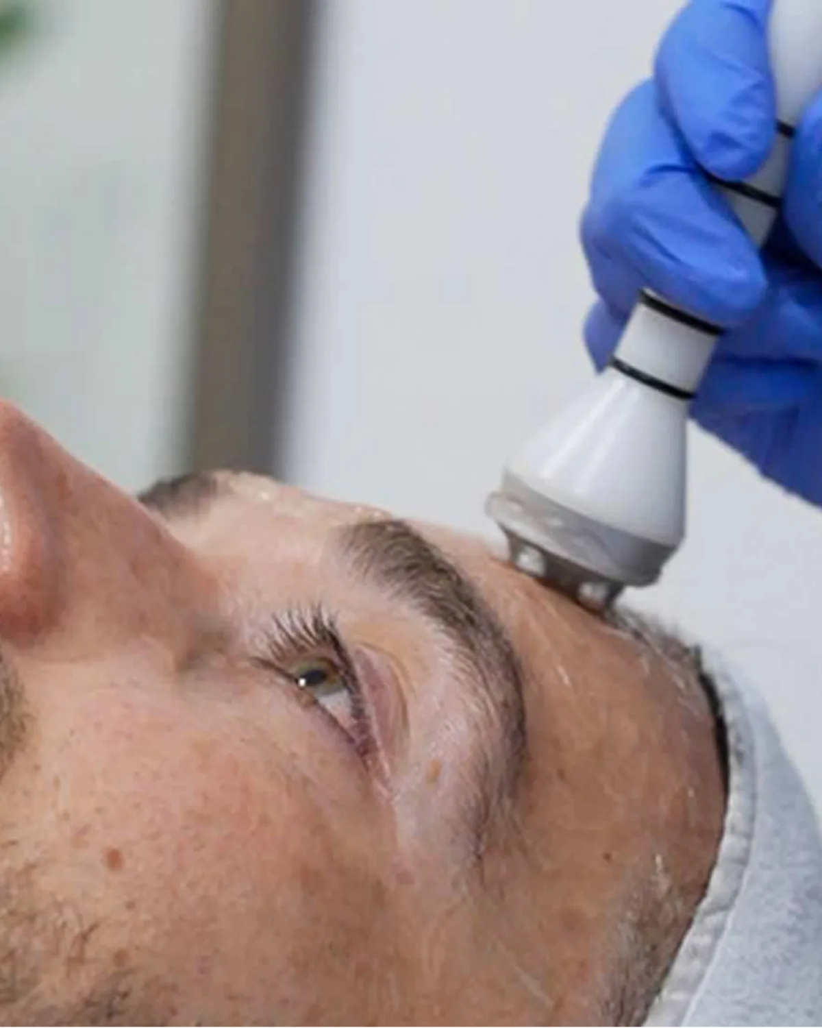 KIOO Hombres: medicina estética discreta para verse bien sin dejar de verse como ellos mismos