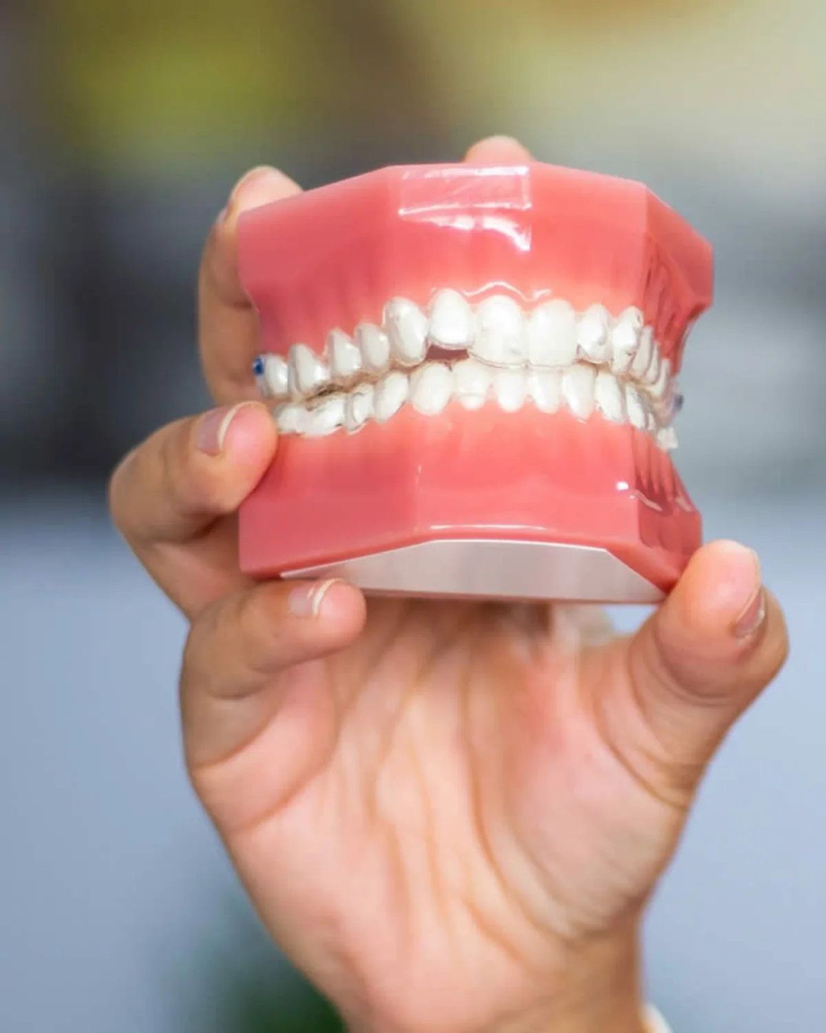 Evita normalizar el dolor de dientes: detecta a tiempo el bruxismo