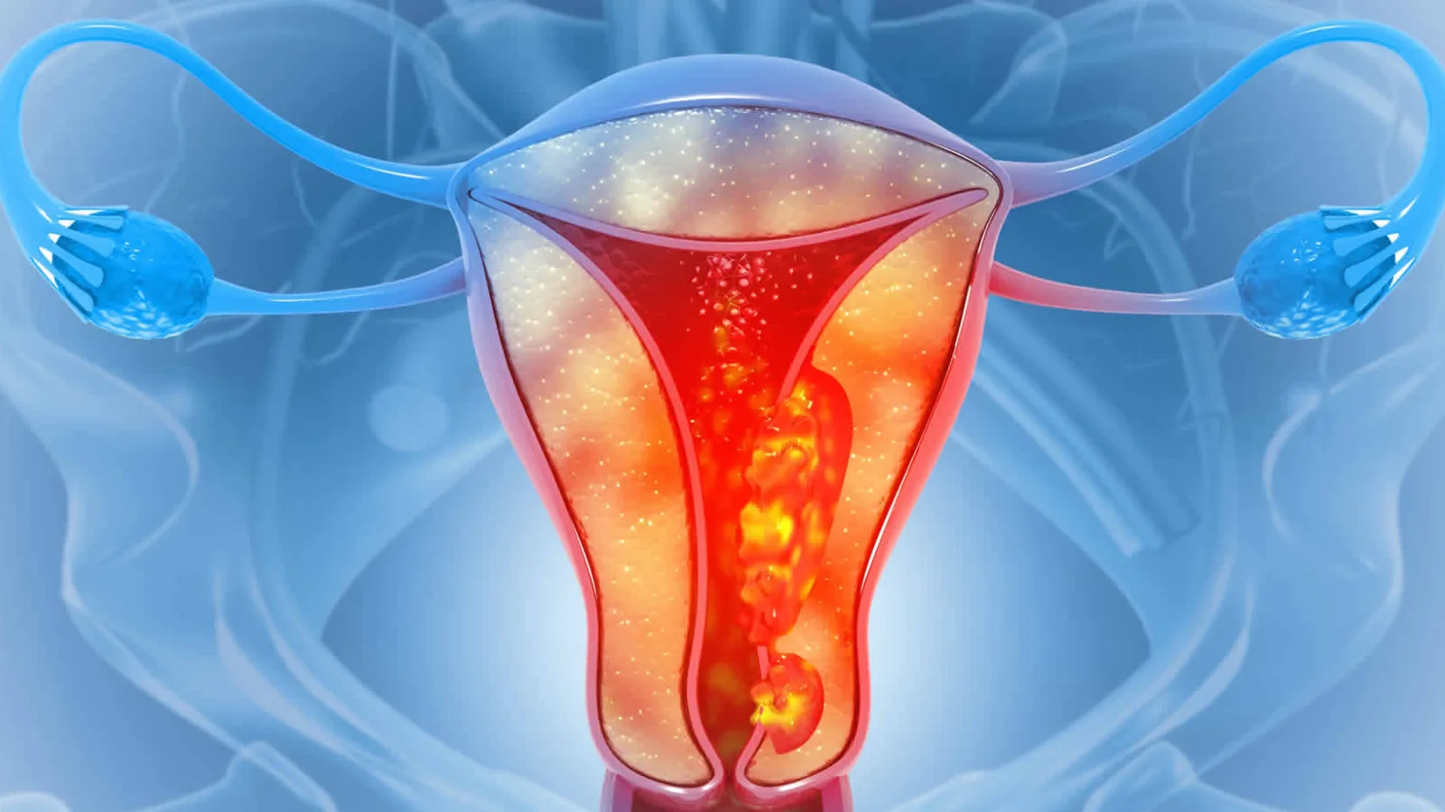 Cáncer ginecológico: tratamientos menos agresivos con la misma eficacia
