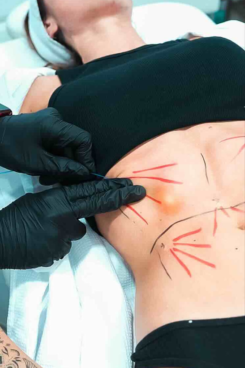 dile-adios-a-la-grasa-localizada-y-a-la-flacidez-abdominal-con-el-nuevo-endolyse-abdominal-de-kioo-medical-and-beauty-center