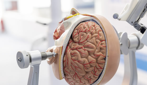 cirugia-cerebral-esperanza-real-para-la-cura-de-la-epilepsia