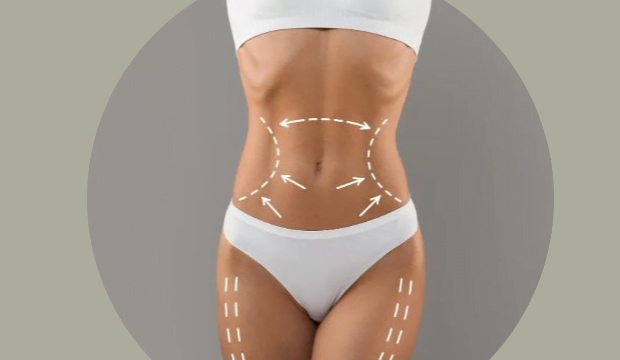 cierra-el-ano-con-una-silueta-renovada-sin-cirugia-y-con-resultados-visibles-desde-la-primera-sesion-con-endolyse-corporal