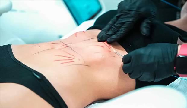 de-las-fiestas-al-bienestar-kioo-center-nos-comparte-los-protocolos-corporales-para-comenzar-el-ano-con-cuerpazo